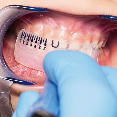 LM-Activator™ OrthoSizer™