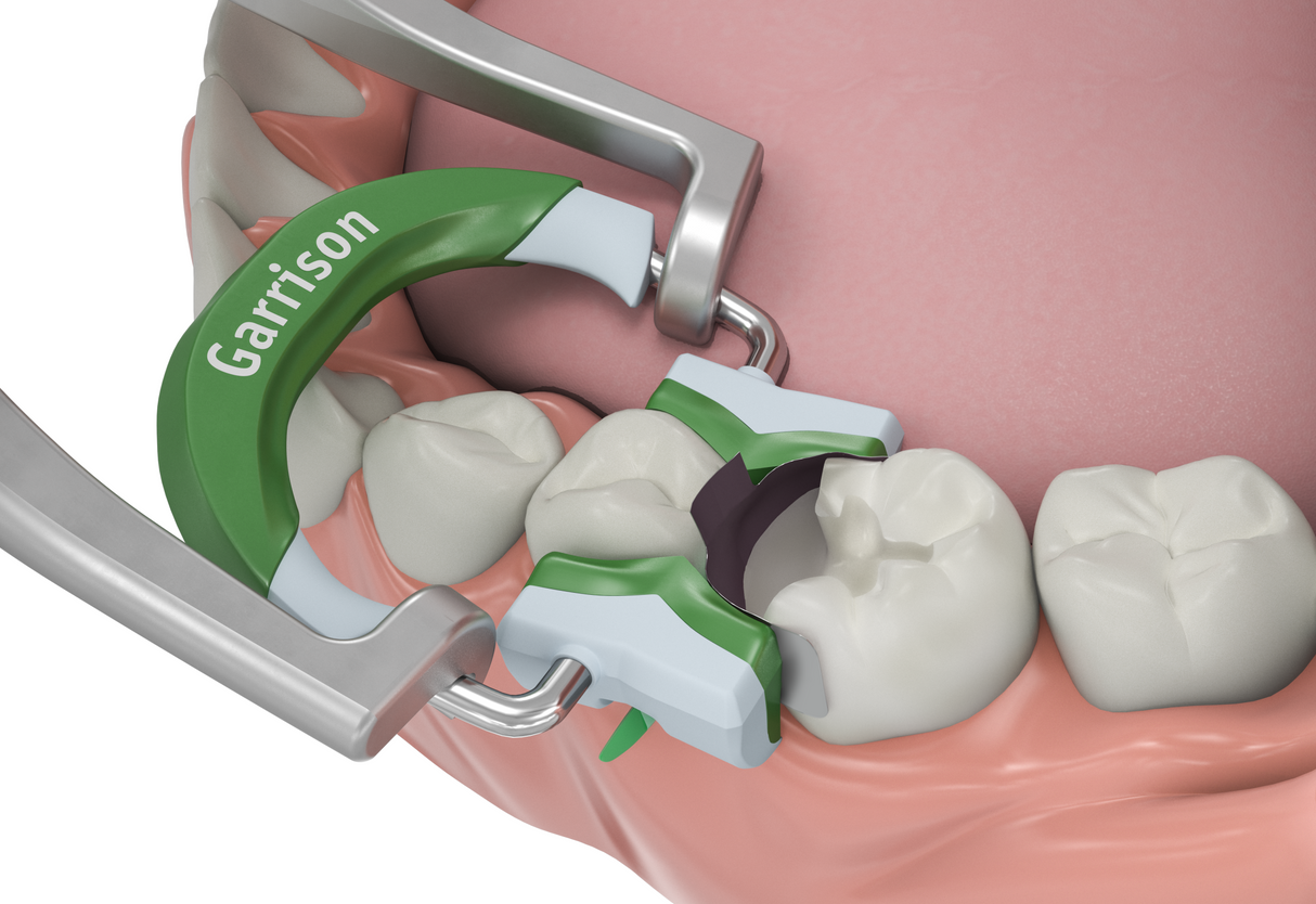 Composi-Tight 3D Fusion Wide Prep Ring Refill(green)
