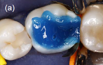 Adhese 2 DC VivaPen Kit 2ml/100