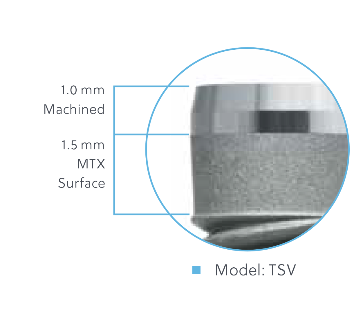 Tapered Screw-Vent® (TSV) Dental Implant System