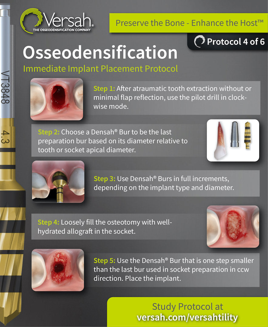 Immediate Implant Placement Protocol