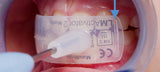 LM-Activator™ OrthoSizer™