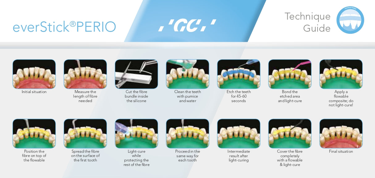 everStickPERIO