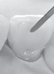 LM-Arte™ Applica