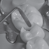 LM-Arte™ Applica Twist