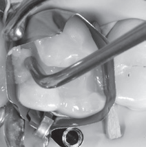LM-Arte™ Condensa