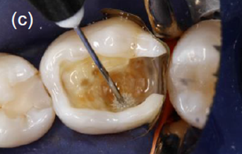 Adhese 2 DC VivaPen Kit 2ml/100