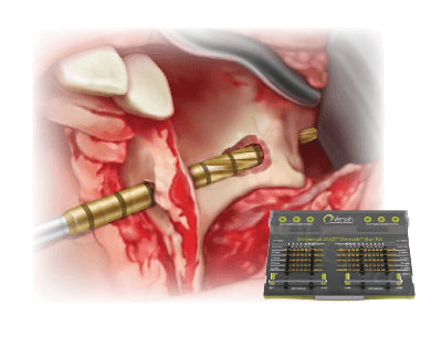 Zygoma Protocol III