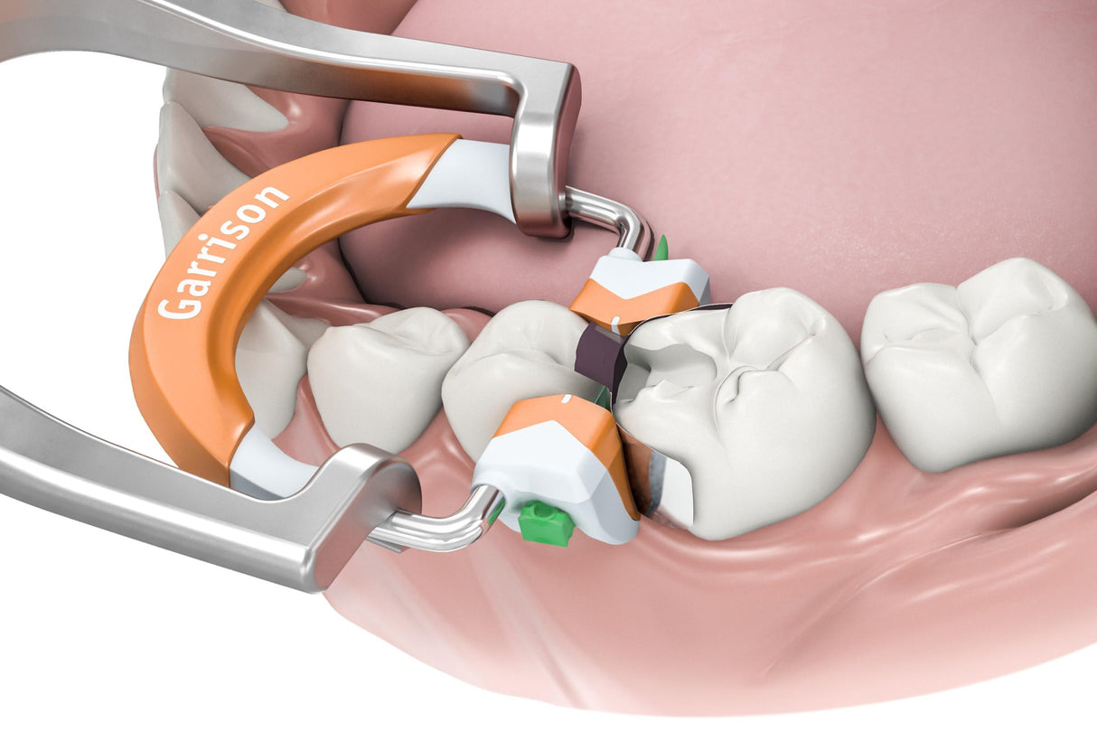 Composi-Tight 3D Fusion Tall Ring Refill(orange)