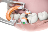 Composi-Tight 3D Fusion Tall Ring Refill(orange)