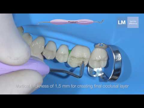 LM-Arte™ Posterior Misura Dark Diamond™