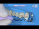 LM-Arte™ Posterior Misura Dark Diamond™
