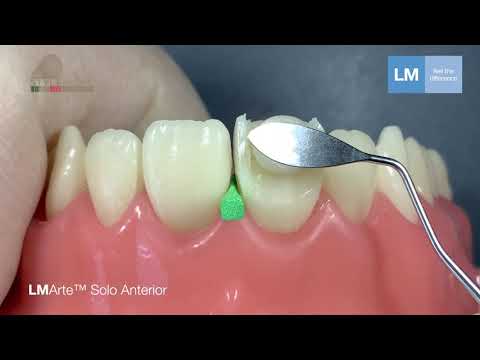 LM-Arte™ Solo Posterior Dark Diamond™