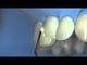 LM-Arte™ Fissura Dark Diamond