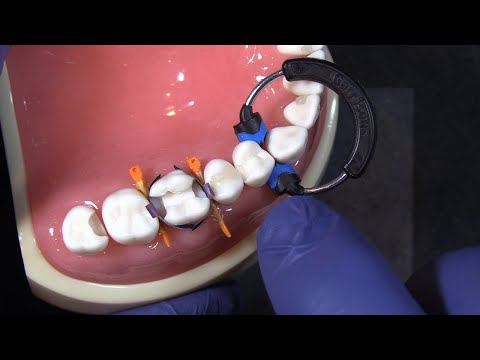 Composi-Tight 3DXR Rings