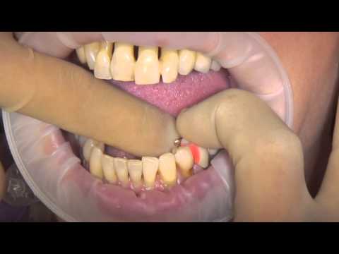 Течен инддикатор Arti-Spot® 3, син