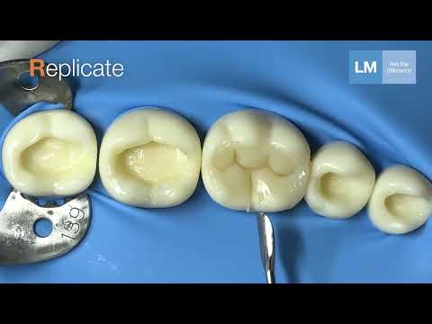 LM-Arte™ Replica Posterior