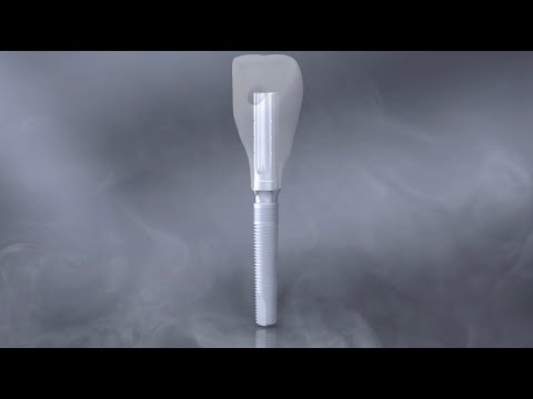 GenTek Angulated Screw Channel TiBase