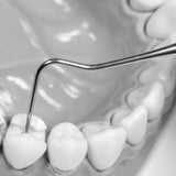 Root Canal Explorer